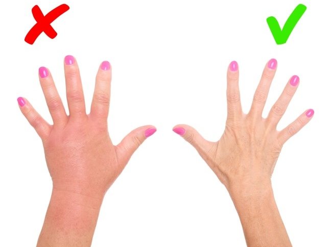 8 abnormal signs on the skin warning the body is having serious health problems Picture 4