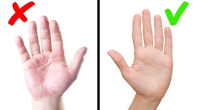 8 abnormal signs on the skin warning the body is having serious health problems Picture 7