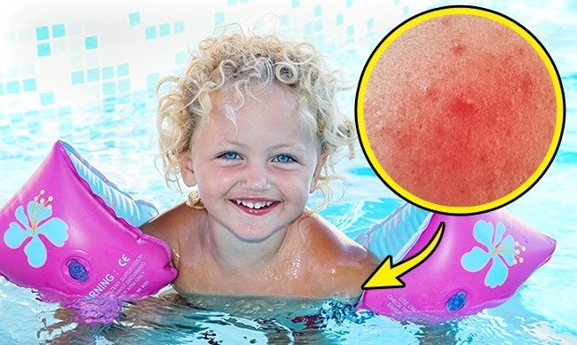 8 dangerous toys can harm children and make the right choice Picture 3