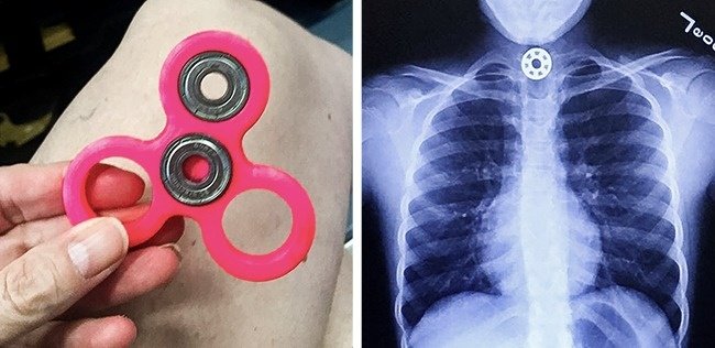 8 dangerous toys can harm children and make the right choice Picture 8