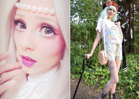 8 incredible and incredible diseases in real life 'step out' from the movie Picture 10