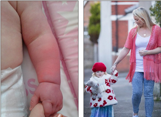 8 incredible and incredible diseases in real life 'step out' from the movie Picture 9