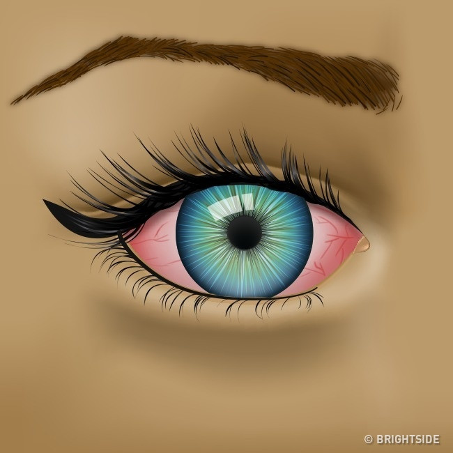 8 signs of abnormal eye warning about your health Picture 3