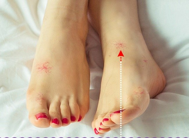 9 abnormal signs in the legs warning the body is having health problems Picture 5