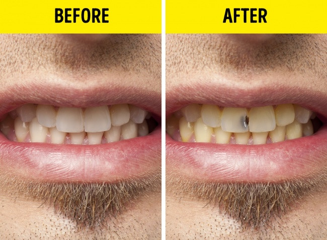 9 bad habits should be removed immediately if you don't want to get in trouble Picture 4