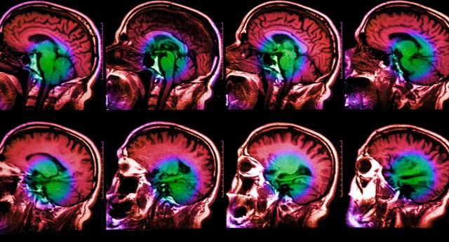 A total of more than 100 human memory-related genes have been identified Picture 1
