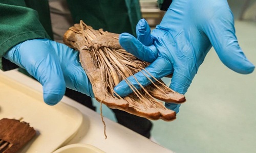 After donating, how will your body be processed? Picture 2