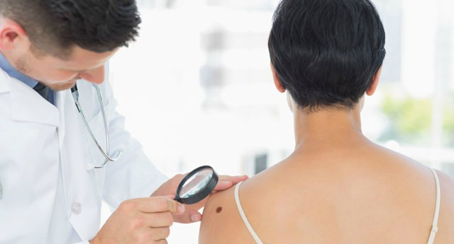 Artificial intelligence can help detect melanoma skin cancer Picture 1