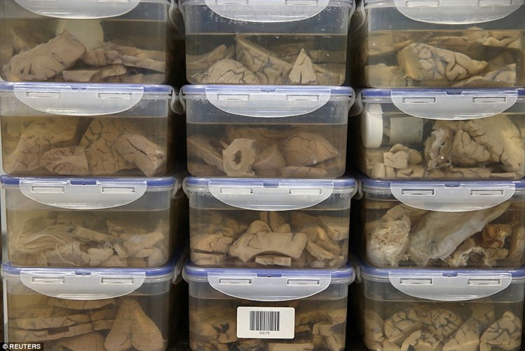 Breaking into the bank holds 1,000 human brains in the UK Picture 1