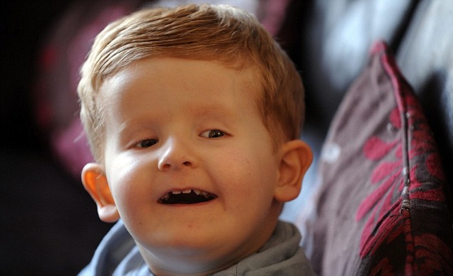 Cases of superfluous body parts in the world Picture 4