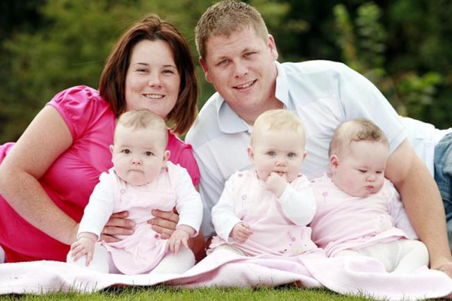 Cases of superfluous body parts in the world Picture 5