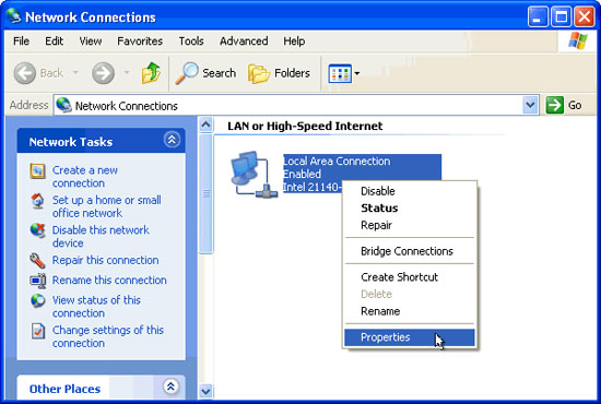 Configure TCP / IP to use DHCP and static IP address at the same time Picture 1