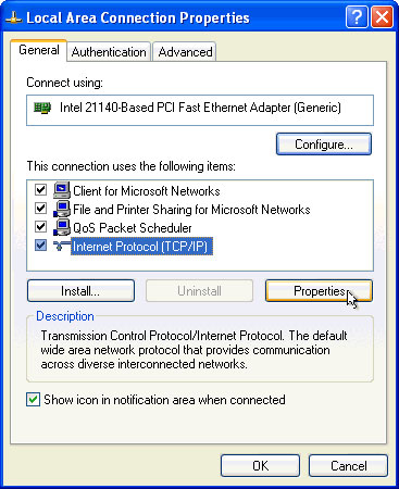 Configure TCP / IP to use DHCP and static IP address at the same time Picture 2