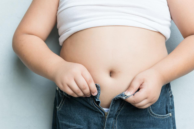 Dental care can protect your child from obesity Picture 1