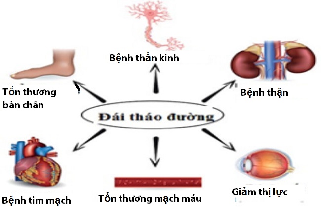 Diabetes - Learn Causes & Symptoms Picture 4