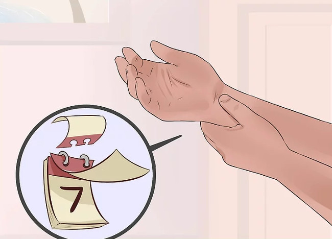 Distinguish between wrist sprains and wrist fractures Picture 5