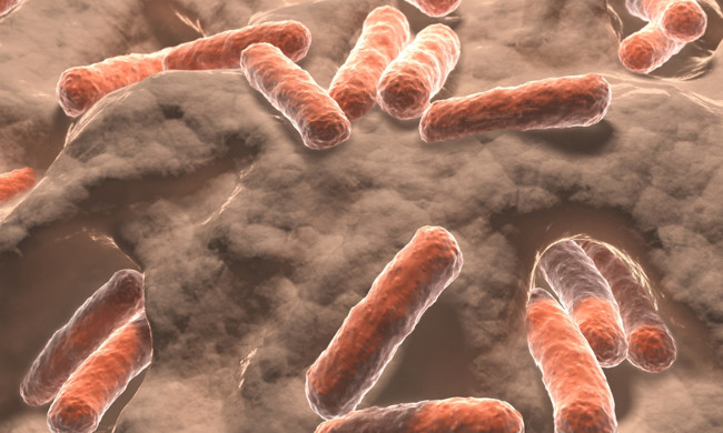 Drug-resistant bacteria greatly affect people living in nursing homes Picture 2