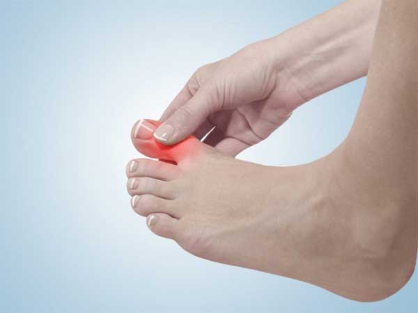 Experience in controlling gout is effective during treatment Picture 2