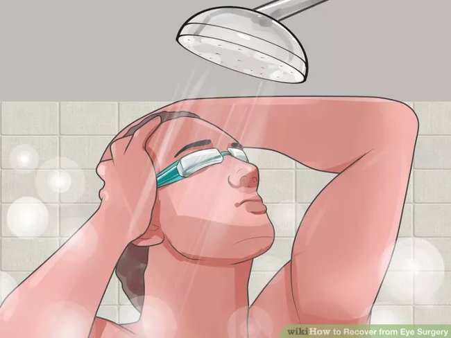 Eye care method properly after surgery Picture 1