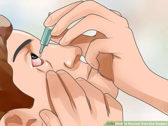 Eye care method properly after surgery Picture 14
