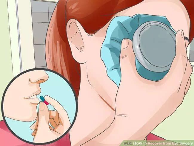 Eye care method properly after surgery Picture 23