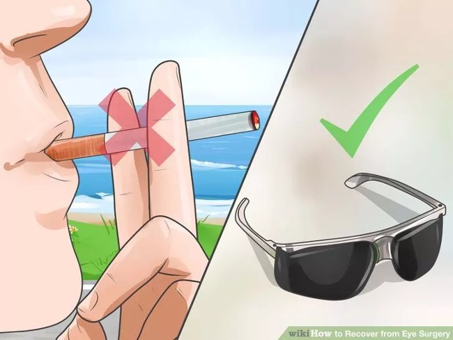 Eye care method properly after surgery Picture 6