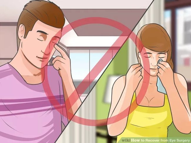 Eye care method properly after surgery Picture 7
