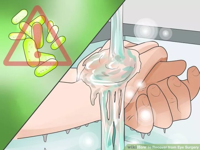 Eye care method properly after surgery Picture 8