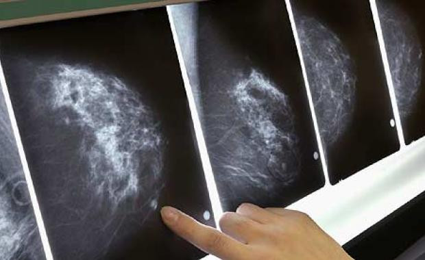 Find new ways to treat breast cancer Picture 1