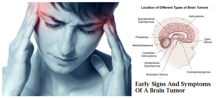 Find out many causes of mental disorders in cancer patients Picture 1