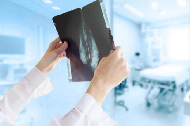 Finding new drugs that treat breast cancer is thought to be well tolerated Picture 1