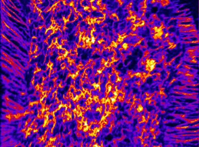 Finding new ways to study cholesterol distribution on cells Picture 1