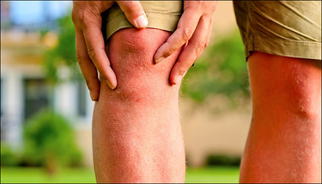 Good news: New drugs can prevent damage and bone loss caused by arthritis Picture 1