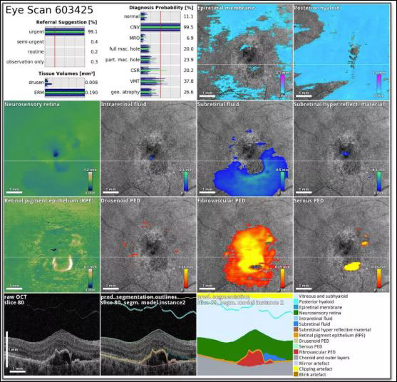 Google's DeepMind can diagnose eye diseases exactly like doctors Picture 1