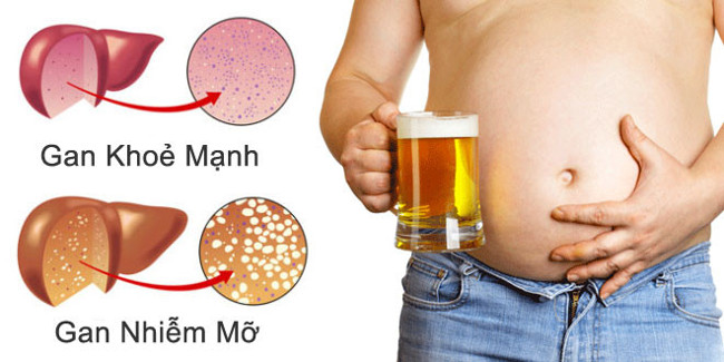 High-protein diets can reduce liver fat Picture 2