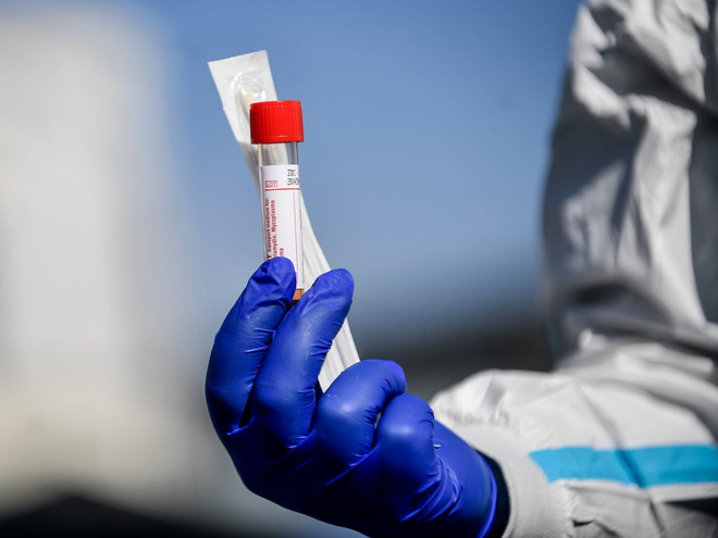 How are scientists knowing whether the Covid-19 patients recover and become infected again? Picture 3