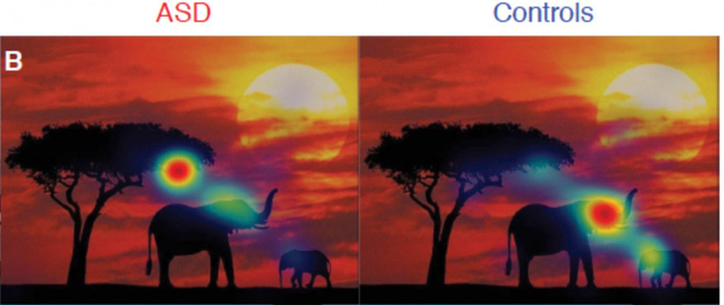 How do people with autism look at the world? Picture 8