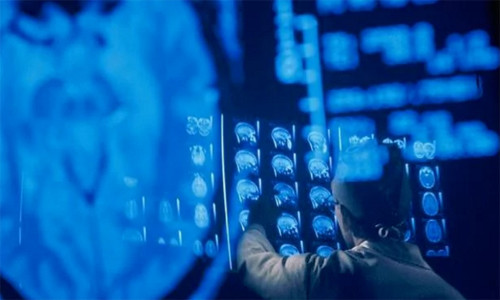 How does India bring the dead dead to life next month? Picture 1