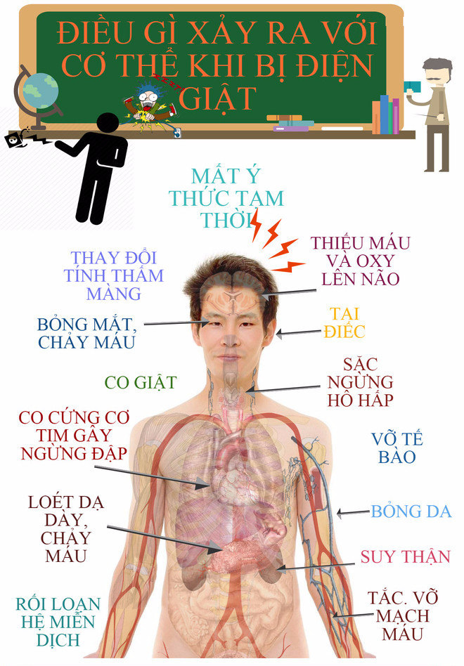 How does the human body change when electrocuted? Picture 1