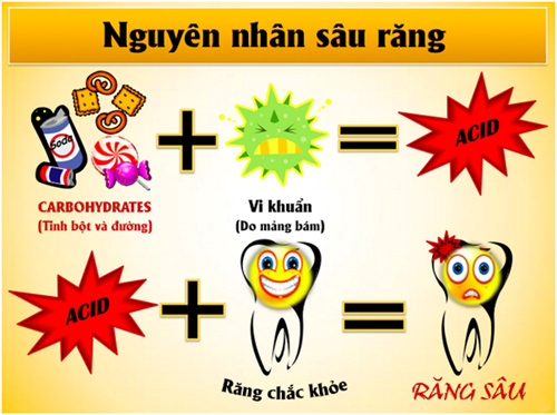 How Does Tooth Decay Take Place Class 7