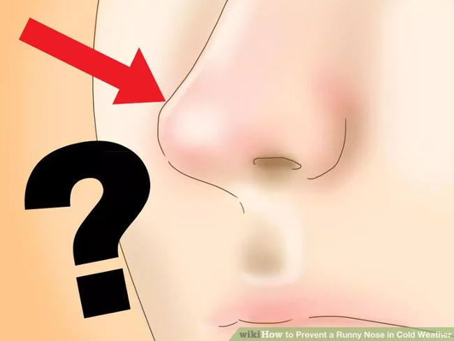 How to avoid runny nose when it is cold? Picture 7