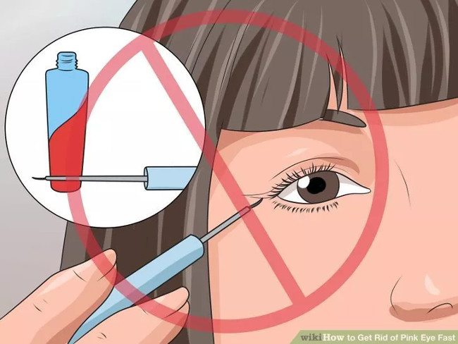 How to cure pinkeye quickly and effectively Picture 8