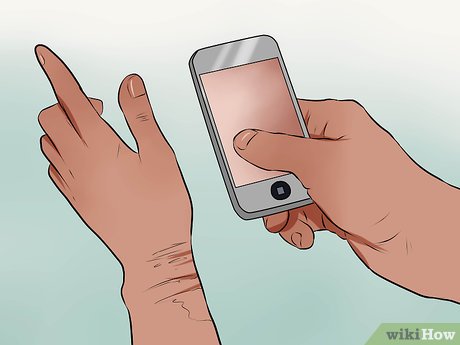 How to Get Compensation from a BUI Accident Picture 8