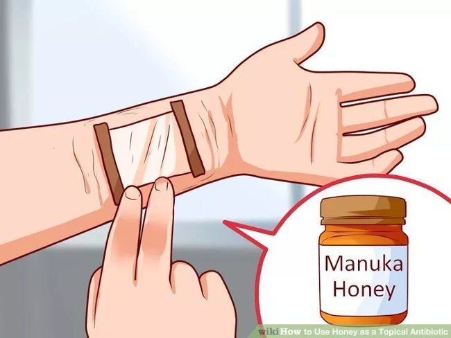 How to heal wounds quickly and effectively with honey Picture 3