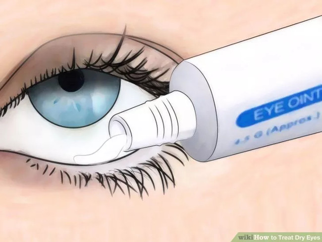 How to prevent and treat dry eyes effectively Picture 5
