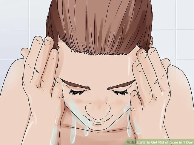 How to remove acne effectively in just 1 day Picture 1