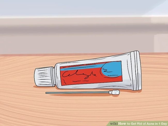 How to remove acne effectively in just 1 day Picture 11