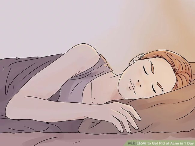 How to remove acne effectively in just 1 day Picture 12