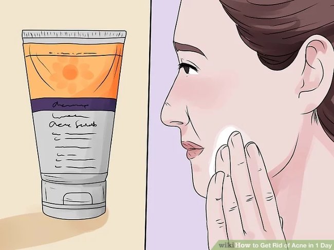 How to remove acne effectively in just 1 day Picture 2