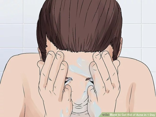 How to remove acne effectively in just 1 day Picture 3